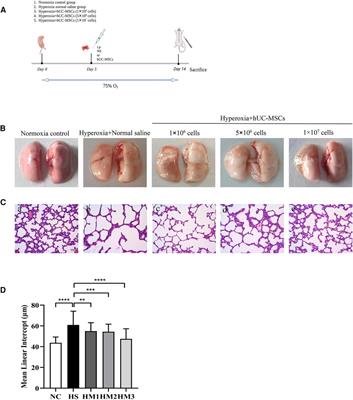 Dose-dependent effects of human umbilical cord-derived mesenchymal stem cell treatment in hyperoxia-induced lung injury of neonatal rats